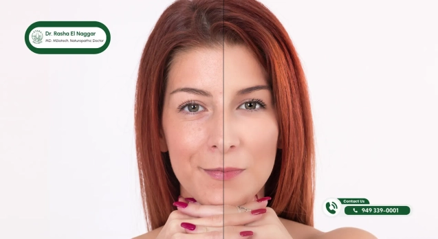 Blog 25 Exosome-therapy-for-skin-rejuvenation-at-Etara-Wellness